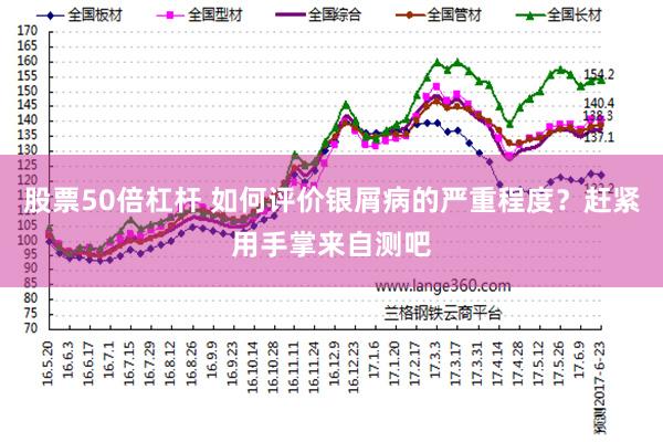 股票50倍杠杆 如何评价银屑病的严重程度？赶紧用手掌来自测吧